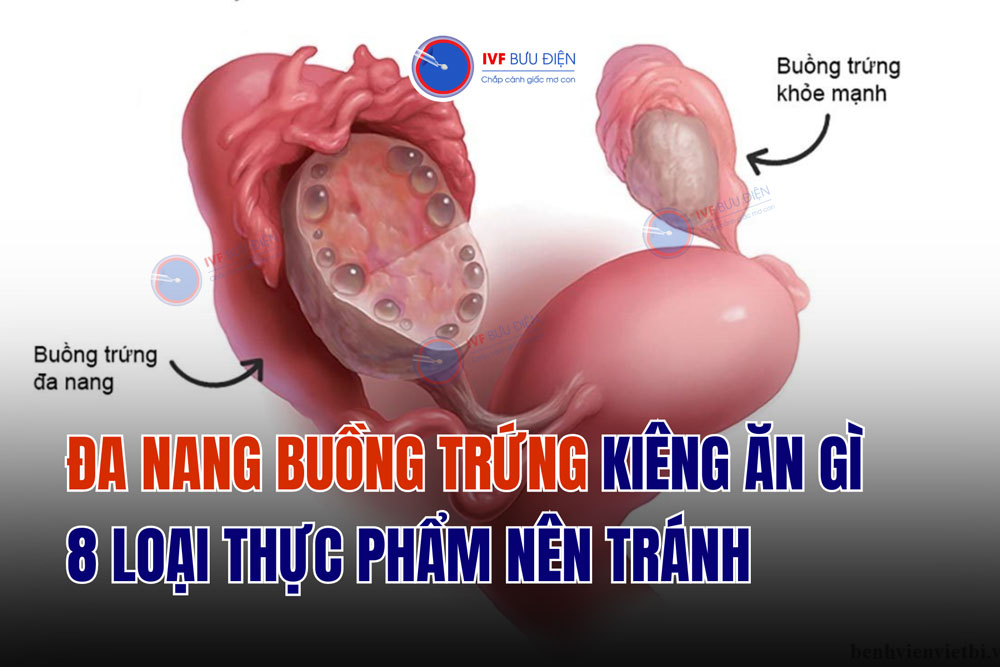 Đa nang buồng trứng kiêng ăn gì: 8 loại thực phẩm nên tránh