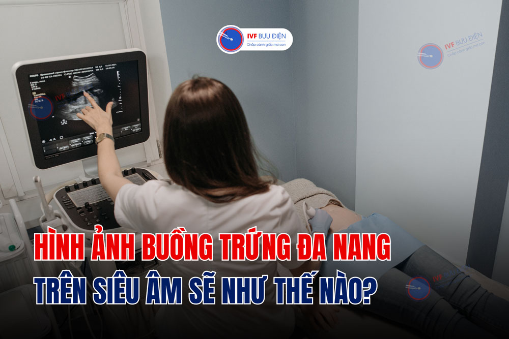 Hình ảnh buồng trứng đa nang trên siêu âm sẽ như thế nào?