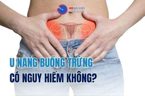 U nang buồng trứng có nguy hiểm không? IVF Bưu Điện