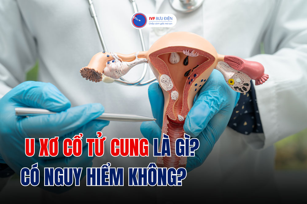 U xơ cổ tử cung là gì? Có nguy hiểm không?