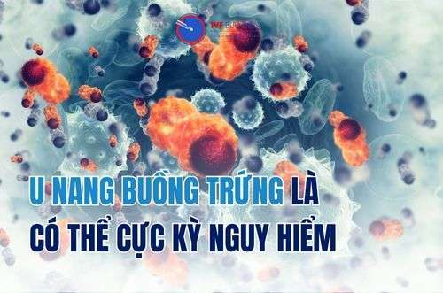 U nang buồng trứng có thể là căn bệnh cực kỳ nguy hiểm