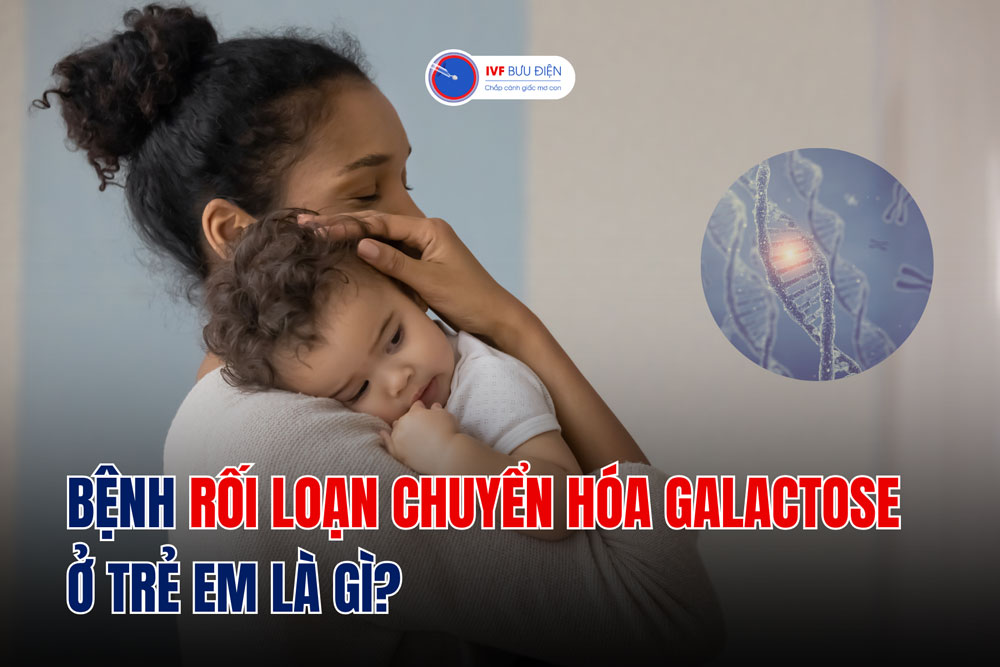 Bệnh rối loạn chuyển hóa galactose ở trẻ em là gì?