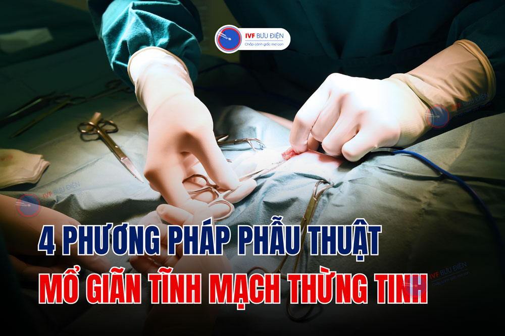 4 phương pháp phẫu thuật mổ giãn tĩnh mạch thừng tinh