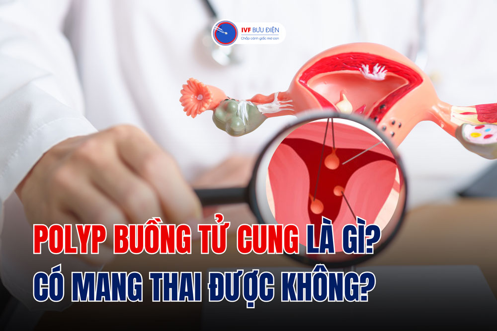 Polyp buồng tử cung là gì? Có mang thai được không?