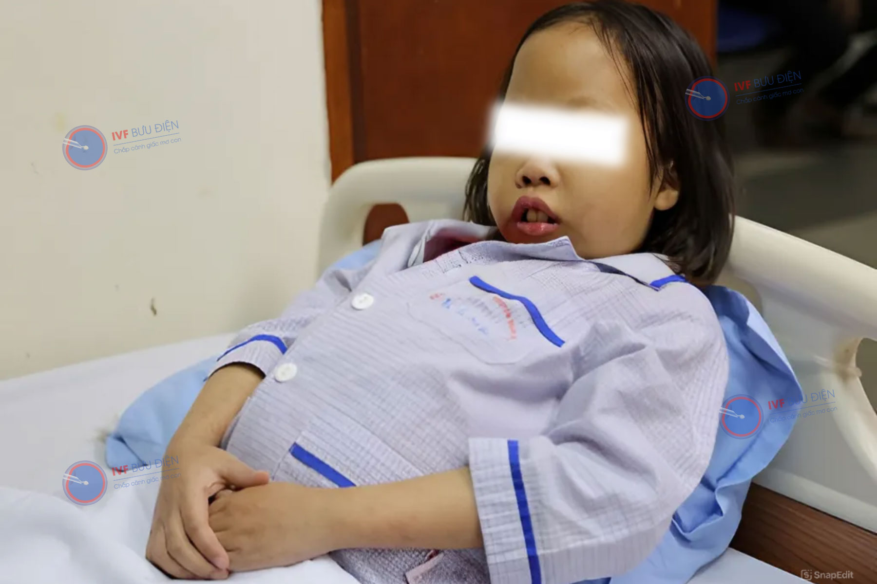 Người mắc Thalassemia có biểu hiện da xanh xao, lách to và cấu trúc xương thay đổi