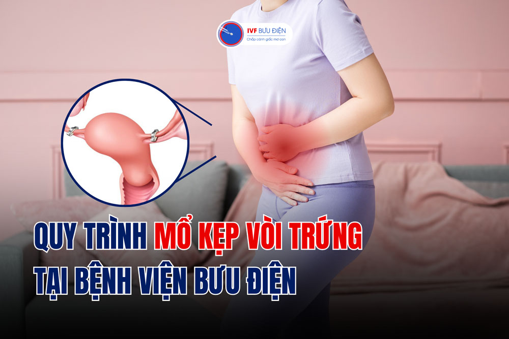 Quy trình mổ kẹp vòi trứng tại Bệnh viện Bưu Điện