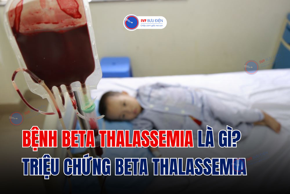 ‎Bệnh beta thalassemia là gì? Triệu chứng beta thalassemia