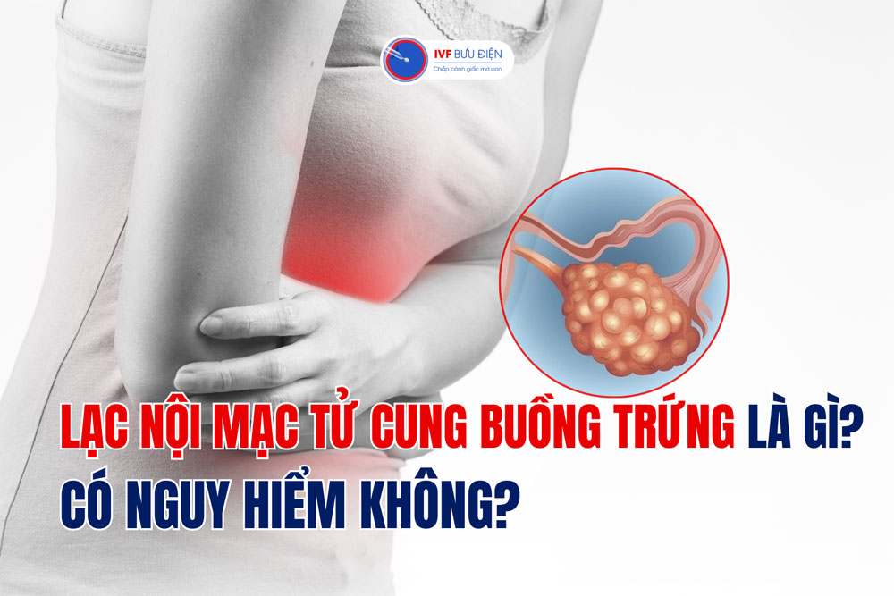 Lạc nội mạc tử cung buồng trứng là gì? Có nguy hiểm không?