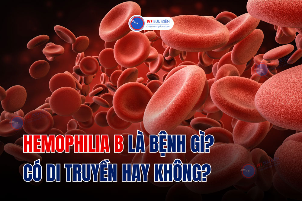 Hemophilia B là bệnh gì? Có di truyền hay không?