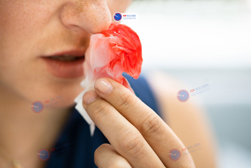 Chảy máu bất thường là một trong những triệu chứng của bệnh