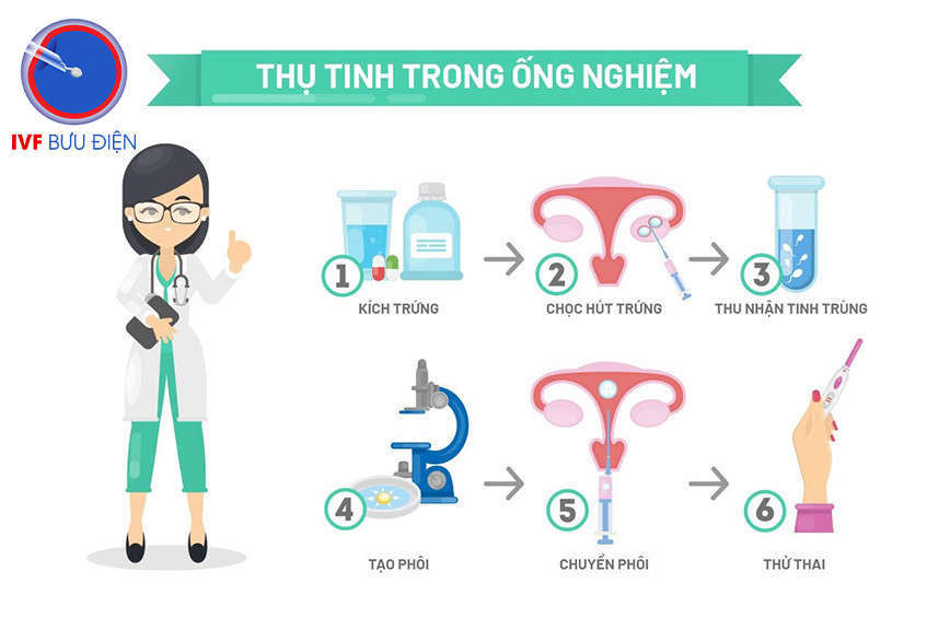 Các bước thụ tinh trong ống nghiệm