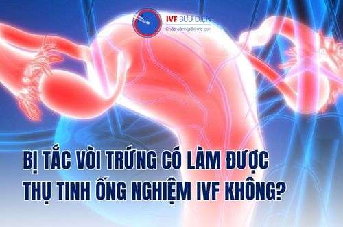 Bị tắc vòi trứng có làm ivf được không? IVF Bưu Điện