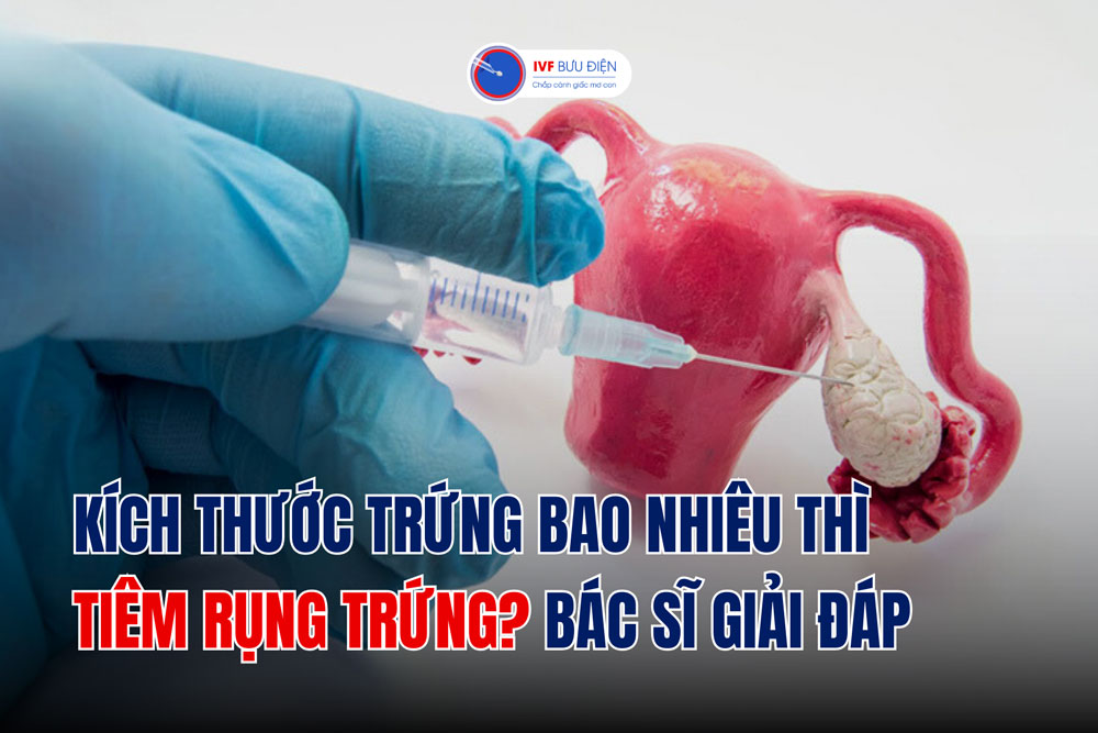 Kích thước trứng bao nhiêu thì tiêm rụng trứng? Bác sĩ giải đáp