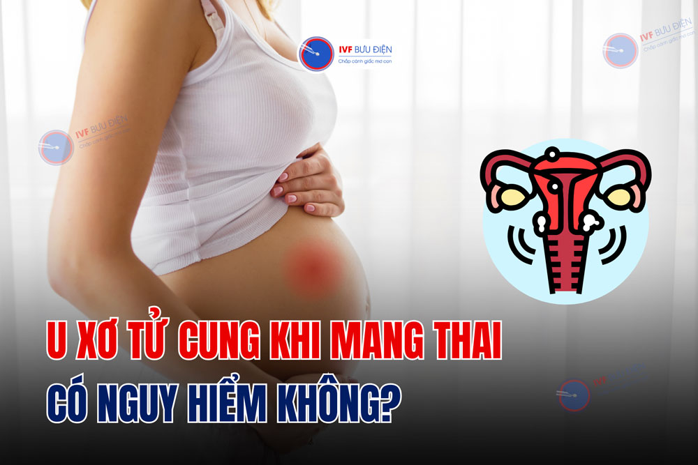 U xơ tử cung khi mang thai có nguy hiểm không?