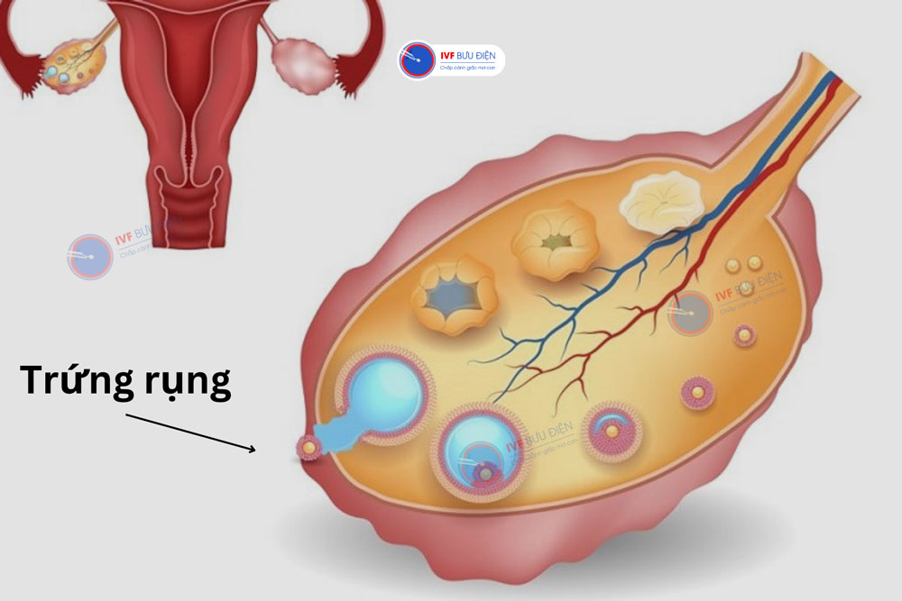 Quá trình phát triển của nang trứng