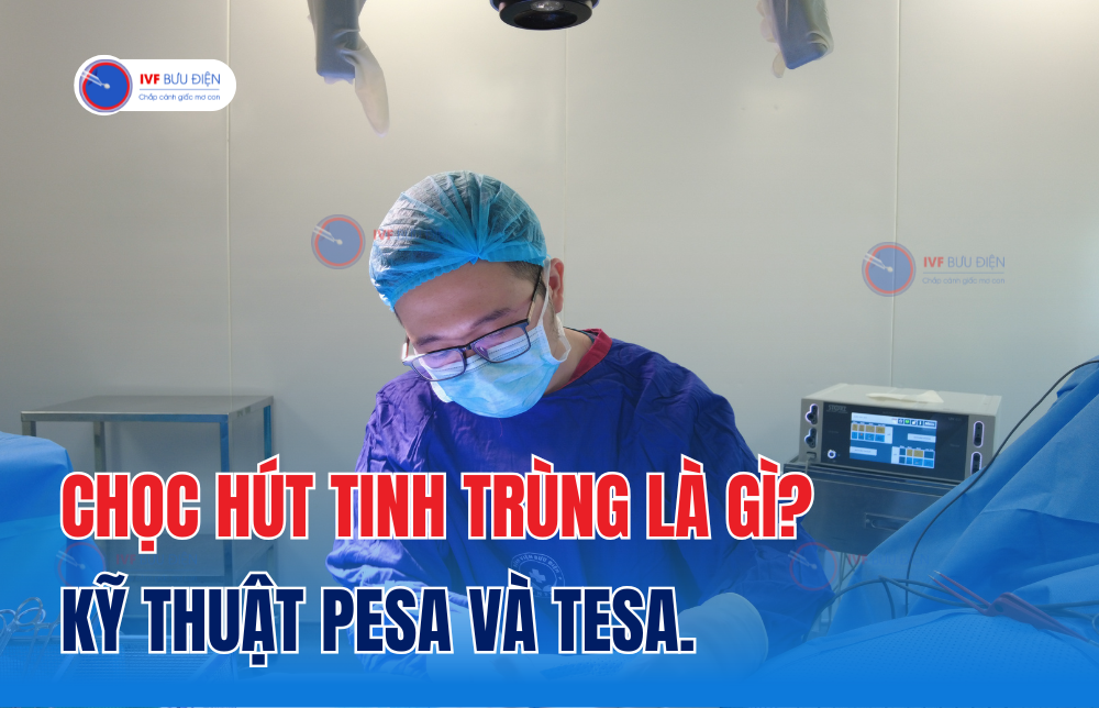 Chọc hút tinh trùng là gì? Kỹ thuật PESA là gì và TESA có gì khác