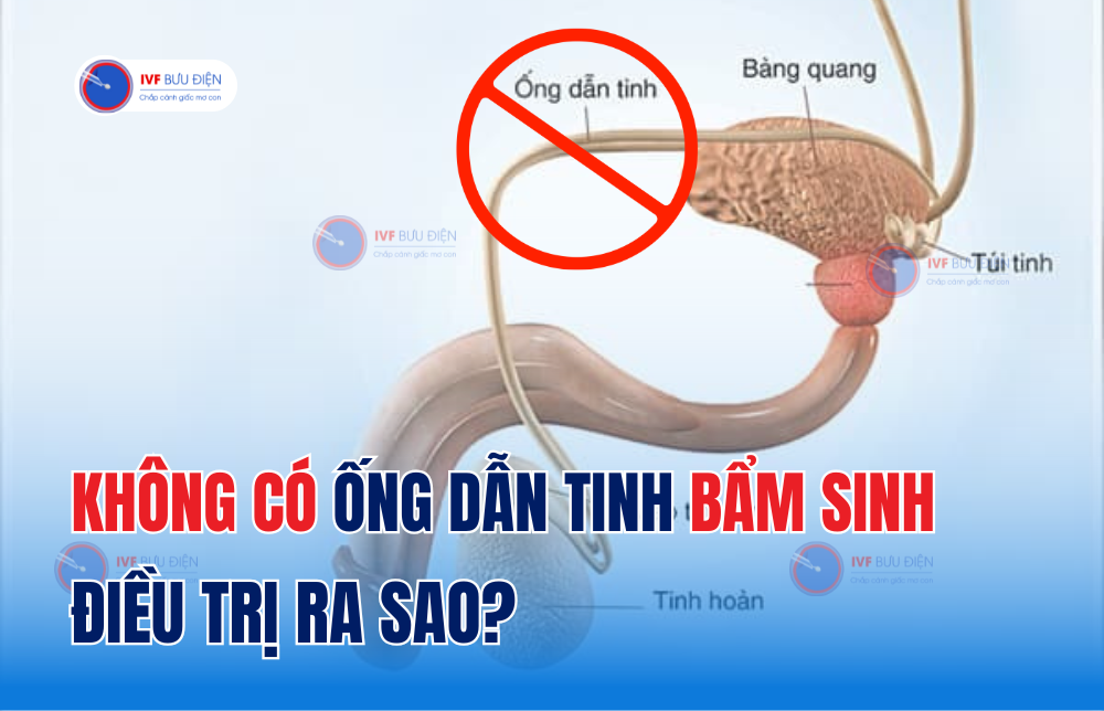 Không có ống dẫn tinh bẩm sinh là gì? Điều trị ra sao?