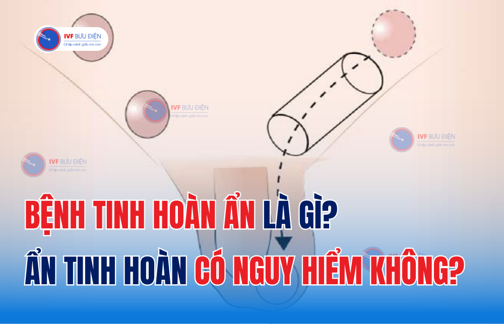 Bệnh tinh hoàn ẩn là gì? ẩn tinh hoàn có nguy hiểm không?