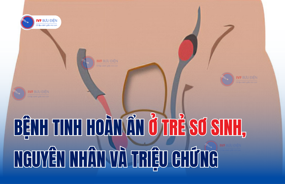 Bệnh tinh hoàn ẩn ở trẻ sơ sinh, nguyên nhân và triệu chứng