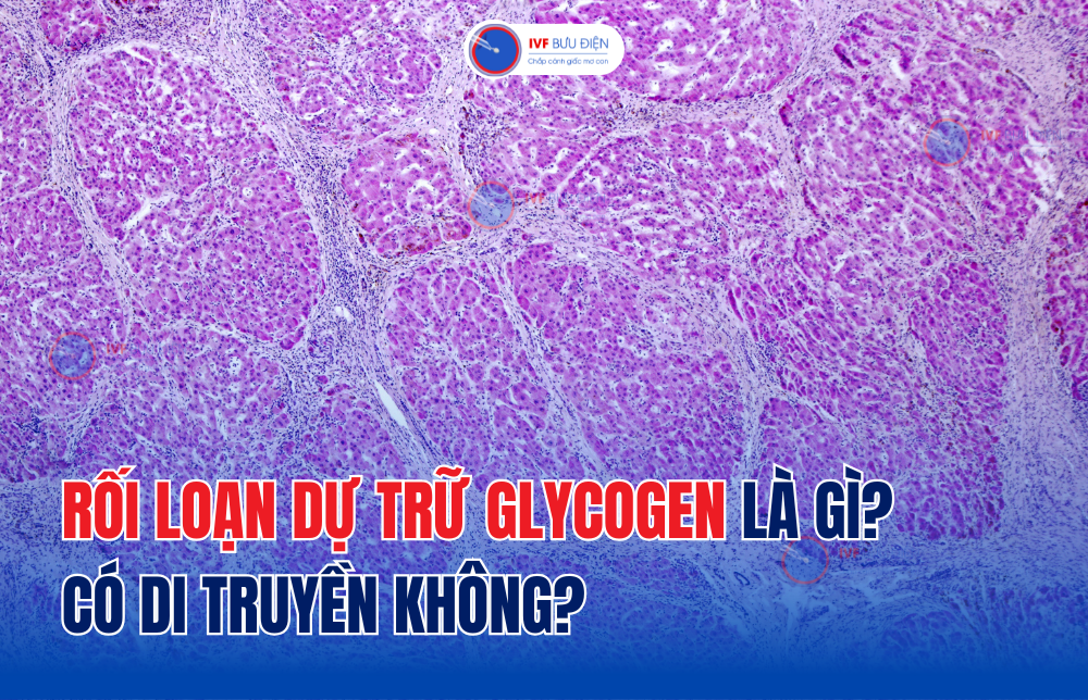 Rối loạn dự trữ glycogen là gì? Có di truyền không?