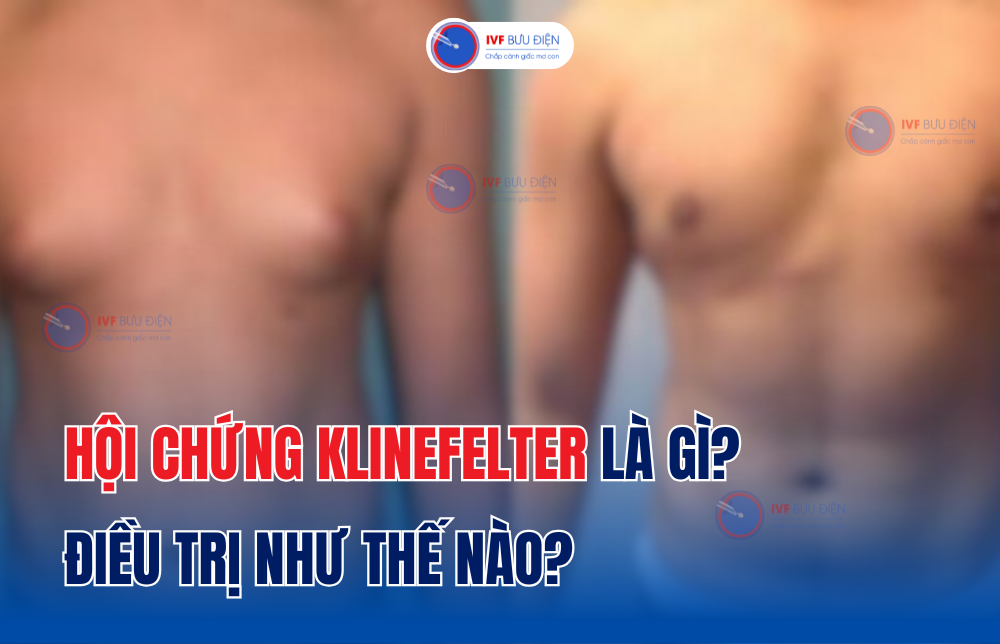 Hội chứng Klinefelter là gì? Điều trị như thế nào?