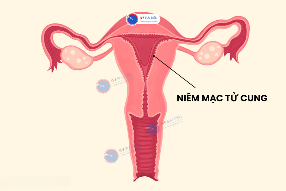 Niêm mạc tử cung