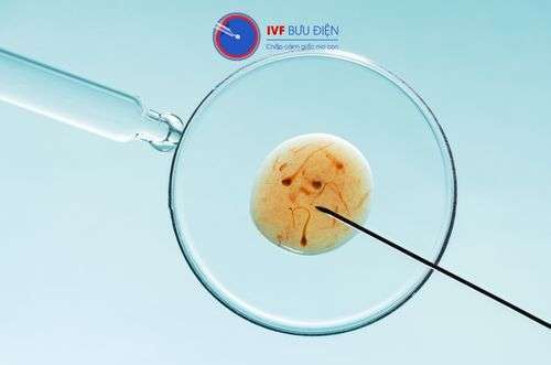 thụ tinh ống nghiệm (ivf)