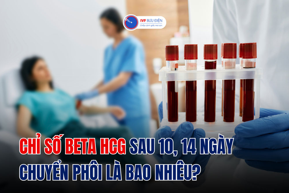 Chỉ số beta HCG sau 14 ngày chuyển phôi là bao nhiêu?