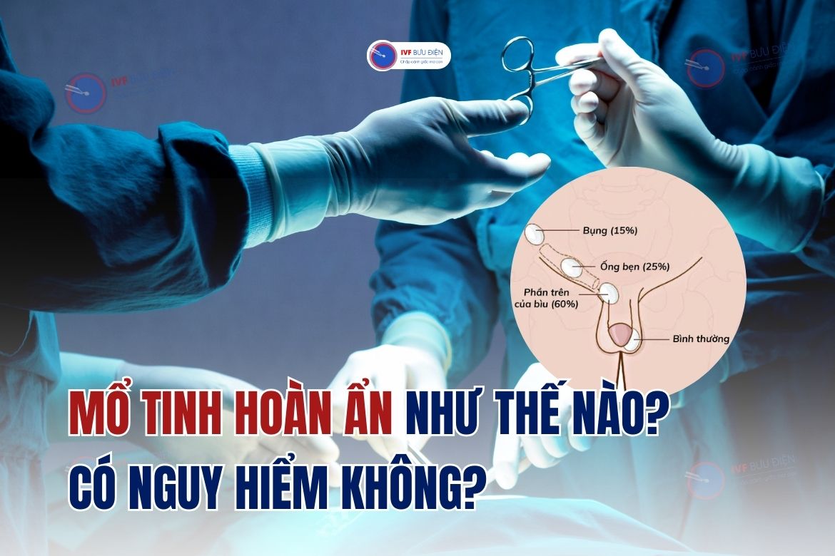 Mổ tinh hoàn ẩn như thế nào? Có nguy hiểm không?
