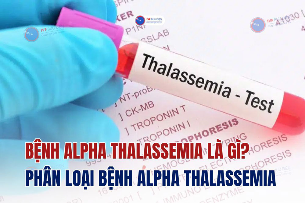 Bệnh Alpha thalassemia là gì? ‎Phân loại bệnh Alpha thalassemia