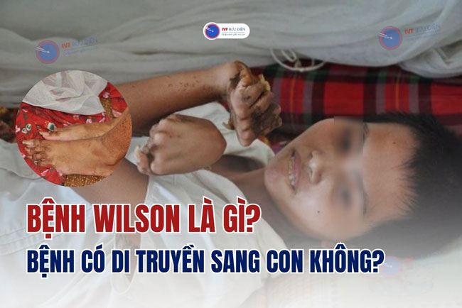 Bệnh Wilson là gì? Bệnh có di truyền sang con không?