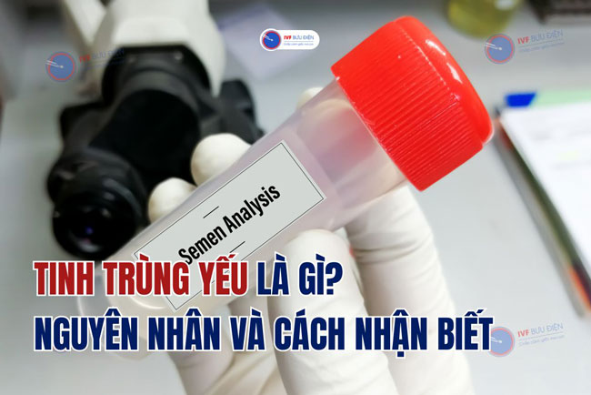 Tinh trùng yếu là gì? Nguyên nhân và cách nhận biết