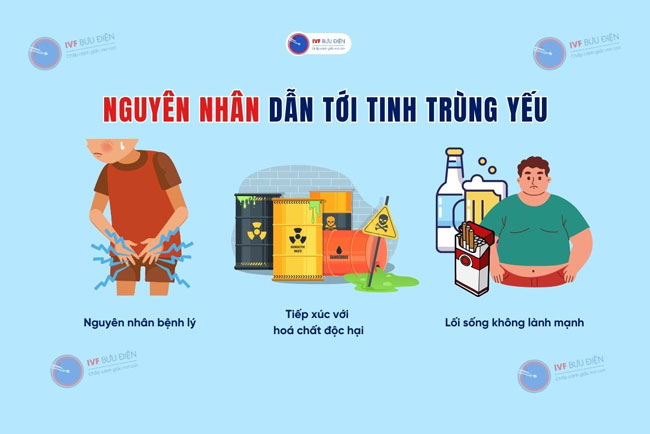 3 nguyên nhân dẫn tới tình trạng tinh trùng yếu