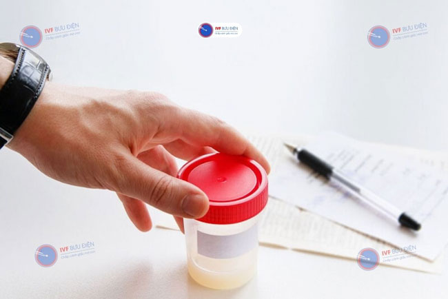 Xét nghiệm tinh dịch đồ giúp phát hiện tình trạng tinh trùng yếu