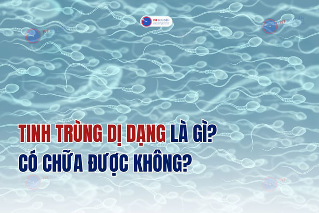 Tinh trùng dị dạng là gì? Có chữa được không?
