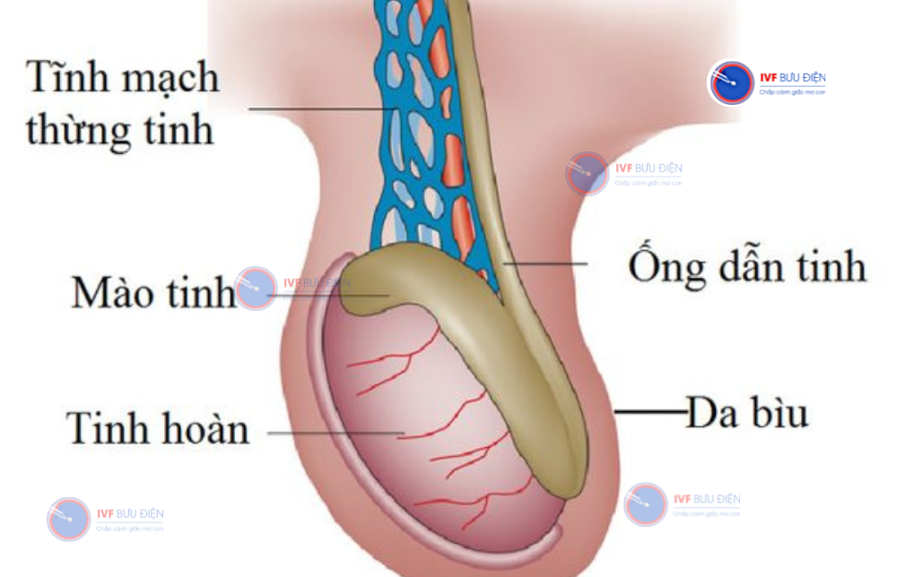 chi phí mổ giãn tĩnh mạch thừng tinh