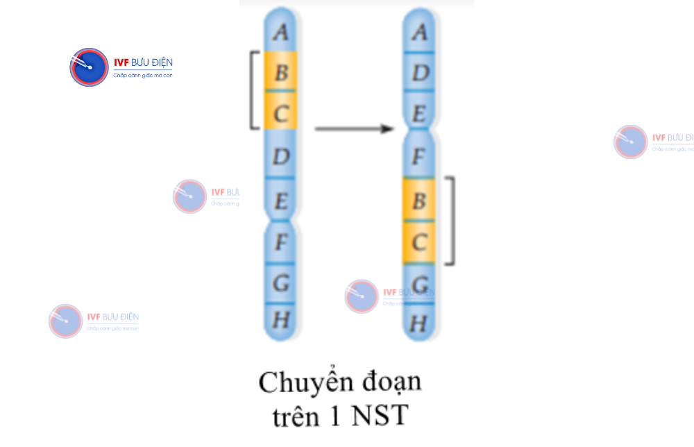 chuyển đoạn NST