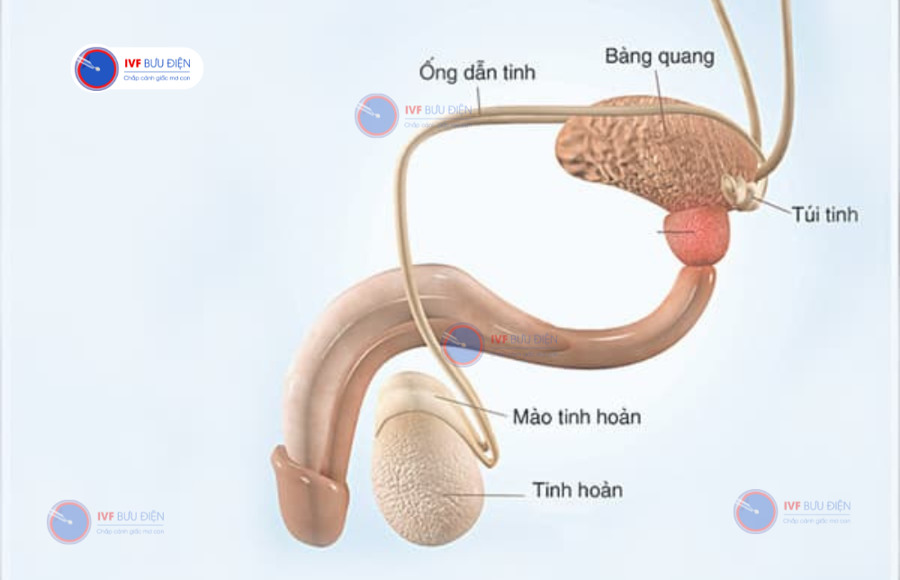 không có ống dẫn tinh