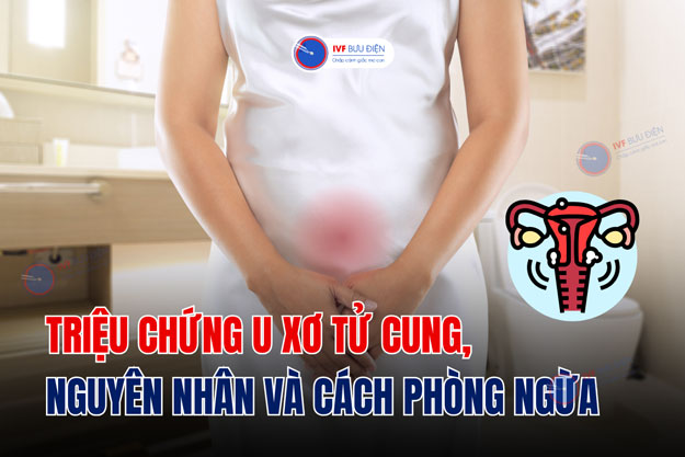 Triệu chứng u xơ tử cung, nguyên nhân và cách phòng ngừa