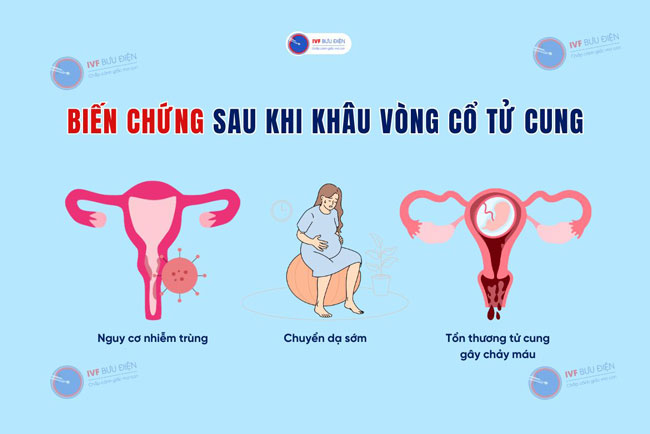 Một số nguy cơ biến chứng sau khi khâu vòng cổ tử cung
