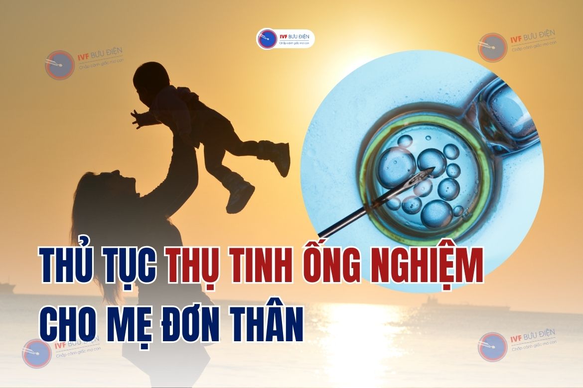 Thủ tục thụ tinh ống nghiệm cho mẹ đơn thân