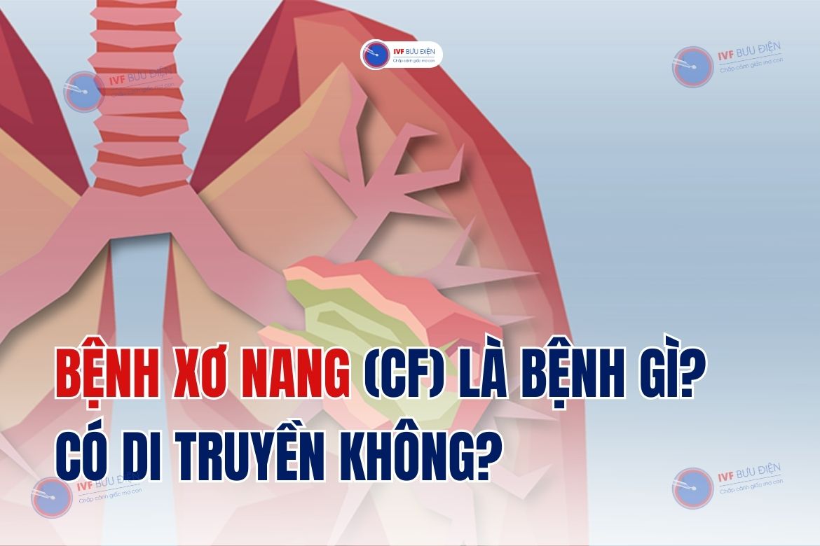 Bệnh xơ nang (CF) là bệnh gì? có di truyền không?