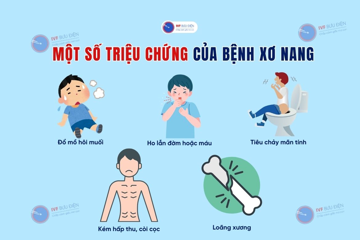  Một số triệu chứng của bệnh xơ nang