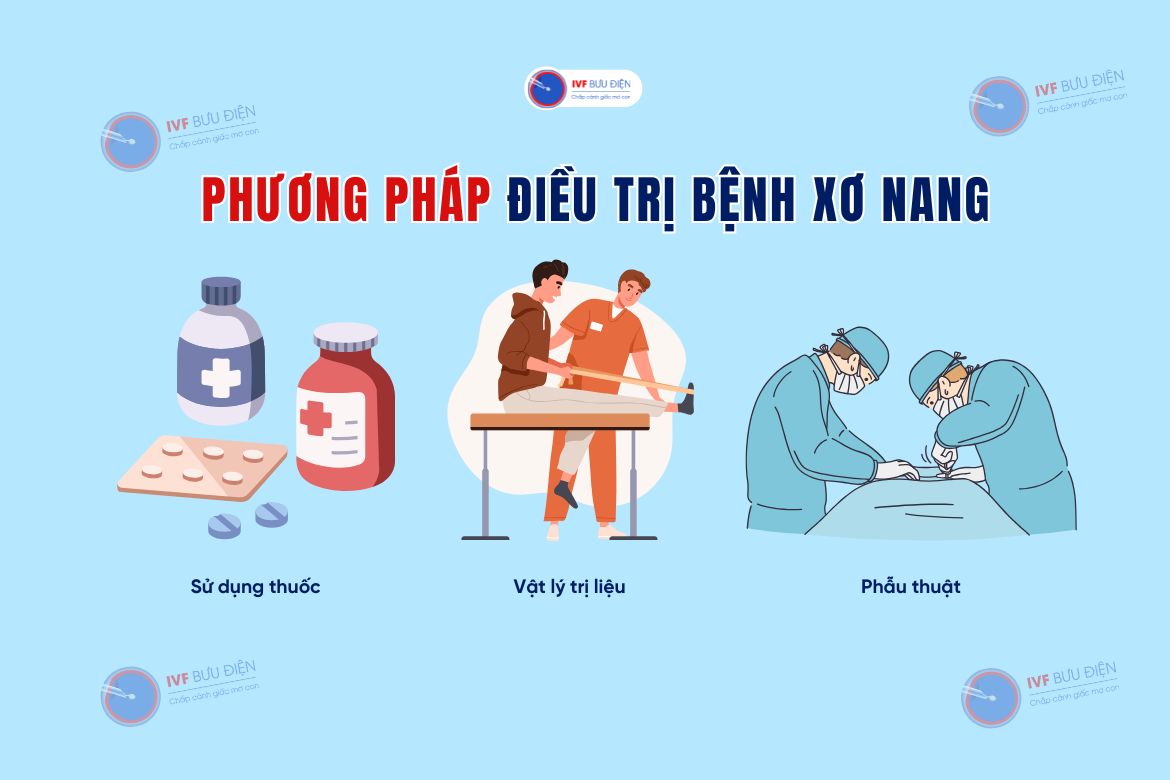 Phương pháp điều trị bệnh xơ nang
