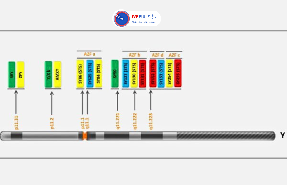 Vi mất đoạn AZF