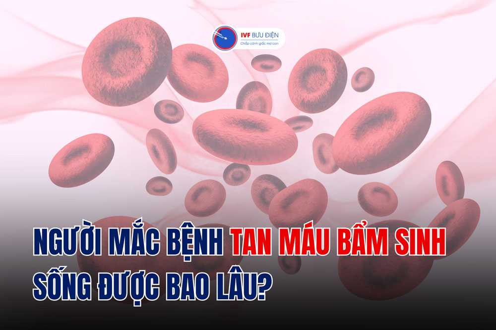 Người mắc bệnh tan máu bẩm sinh sống được bao lâu?