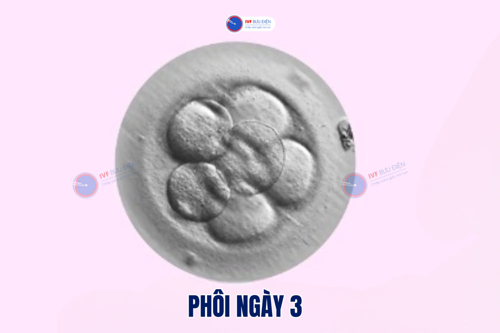 Chất lượng phôi ngày 3 thường phản ánh chất lượng trứng