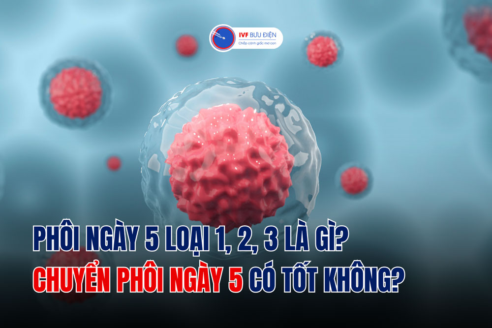 Phôi ngày 5 loại 1, 2, 3 là gì? Chuyển phôi ngày 5 có tốt không?