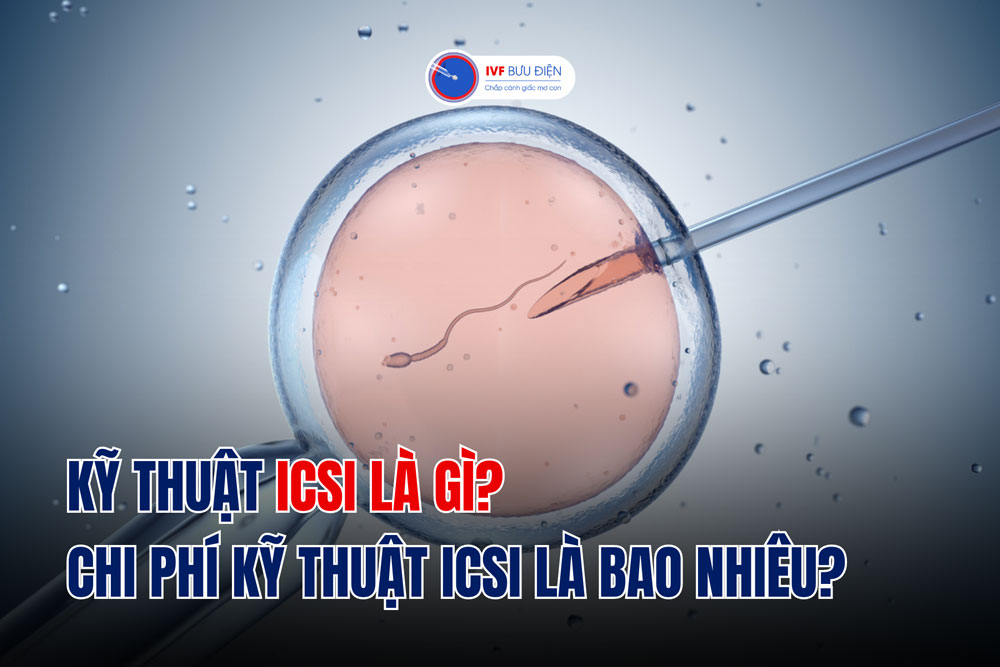 Kỹ thuật ICSI là gì? chi phí kỹ thuật ICSI là bao nhiêu?