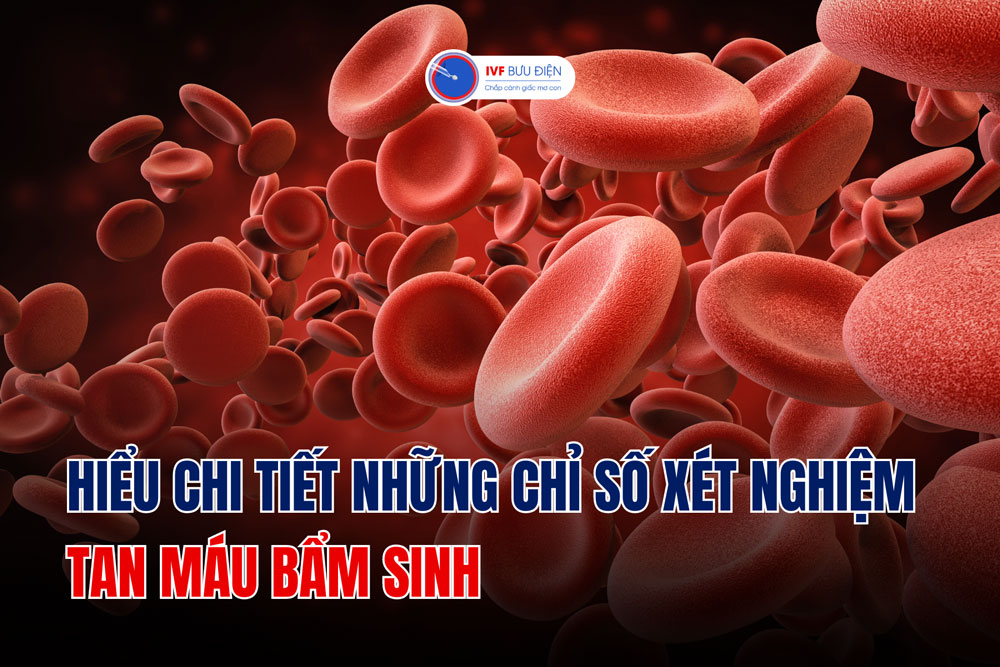 Hiểu chi tiết những chỉ số xét nghiệm tan máu bẩm sinh